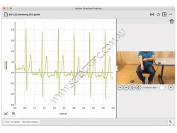 Click to enlarge GA-Pro_Monitoring-EKG.jpg