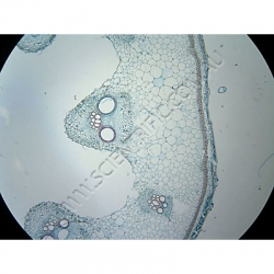 Click to enlarge K1615-Plant-cytology-collenchyma-TS-cucurbit-cortex.jpg
