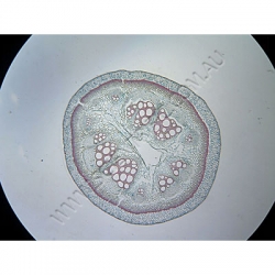 Click to enlarge K1625-Sclerenchyma-vascular-cylinder-aristolochia-stem.jpg