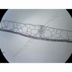K1626-Sclerids--TS-nymphaea-leaf.jpg