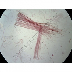 K1637-Macerated-tissues-Zea-Mays-(corn-stem)-2.jpg