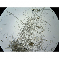Click to enlarge K1688-Porifera-Grantia-WM-Calcareous-spicules.jpg