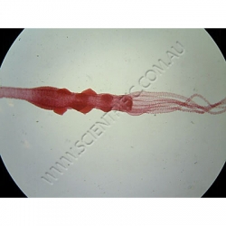K1693-Cnidaria-(hydrozoa)-hydra-with-testes-WM.jpg