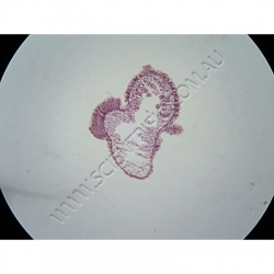 K1694B-Cnidaria-(hydrozoa)-hydra-with-Ovaries-TS.jpg