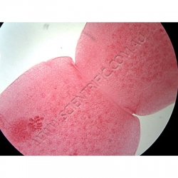 Click to enlarge K1731B-Cestoda-Dipyllidium-caninum-WM-Scolex-mature--gravidsegmetB.jpg