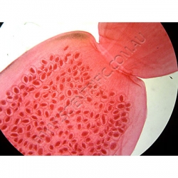 Click to enlarge K1731B-Cestoda-Dipyllidium-caninum-WM-Scolex-mature--gravidsegmetC.jpg