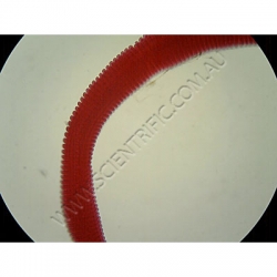 Click to enlarge K1736-Hymenolepis-Scolex-WM.jpg