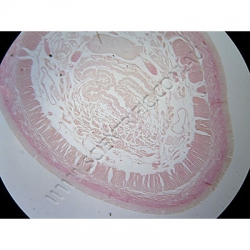 K1758-Annelida--Lumbricus-(Earthworm)-Ts-Pharynx.jpg