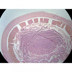 K1759-Annelida--Lumbricus-(Earthworm)-Ts-oesophagus.jpg