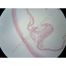 K1768-Annelida--Lumbricus-(Earthworm)-Ts-Gizzard.jpg