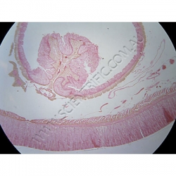 K1769-Annelida--Lumbricus-(Earthworm)-Ts-Clitellum.jpg