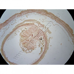 K1770-Annelida--Lumbricus-(Earthworm)-Ts-Intestine.jpg