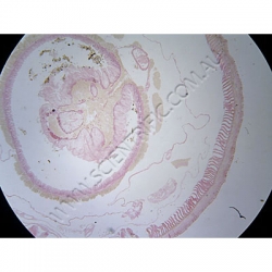 K1771-Annelida-Lumbricus-(Earthworm)-ts-seta.jpg