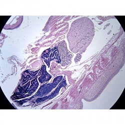 K1774-Lumbricus-(Earthworm)-median-ls-anterior-region.jpg